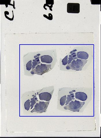 Media type: image; Special Collections 3298   shows specimen_part histological serial section;